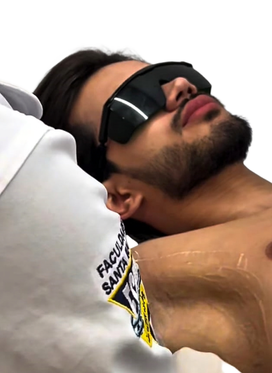 Depilação a laser masculina — Vibe Laser